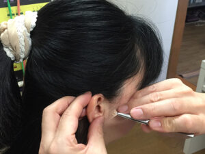耳つぼ痩身で 健康的に減量を 　ふじおか理学療術院